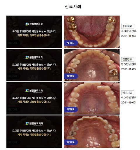 동삭동치과 - 평점좋은 평택본플란트치과